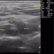 Ultrasound image with machine settings panel