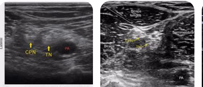 Ultrasound images comparing gain settings
